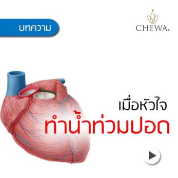 EP40 น้ำท่วมปอดเพราะโรคหัวใจ