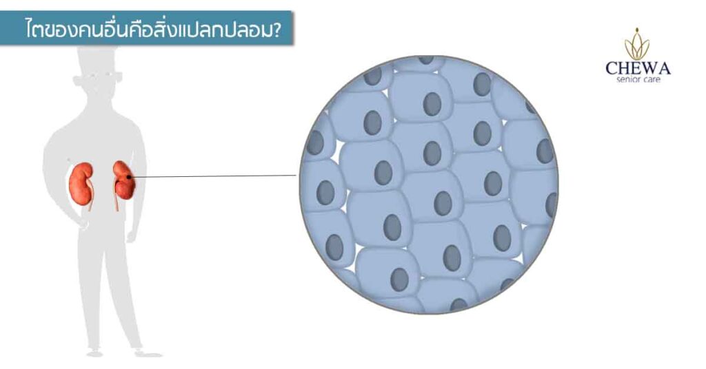การผ่าตัดปลูกถ่ายไต ตอนที่3 ใครคือผู้ให้ไต?