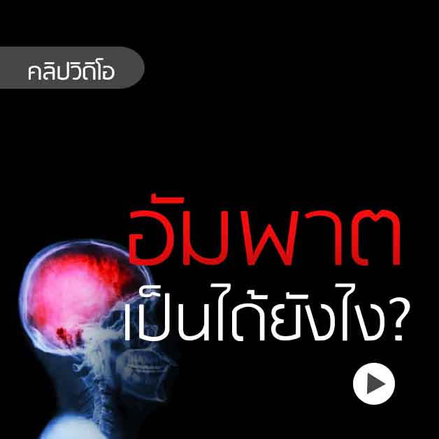 อัมพาต