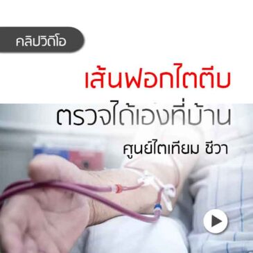 Ep142 เส้นฟอกไต ตีบ ตรวจได้เองที่บ้าน