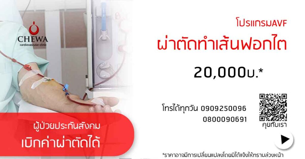 คลิยิกทำเส้นฟอกไต