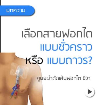 Ep202 เลือกสายฟอกไตฝังที่คอ หรือฝังหน้าอกดี ?