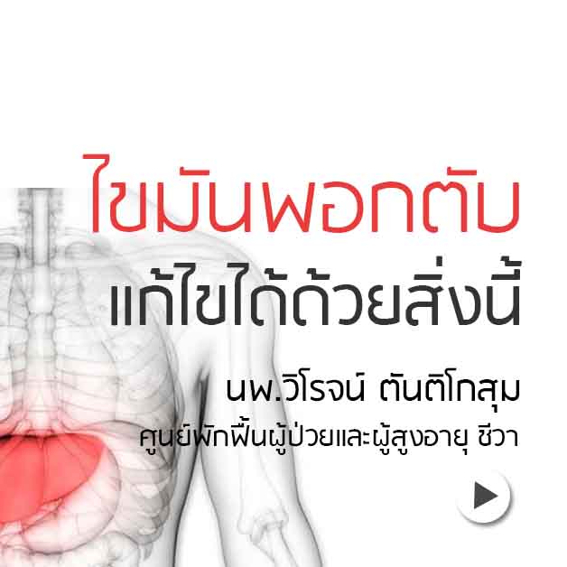 ไขมันพอกตับ