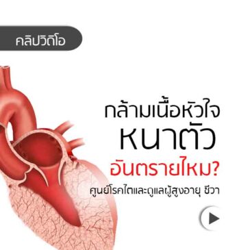 Ep162 โรคกล้ามเนื้อหัวใจหนาตัว อันตรายไหม?