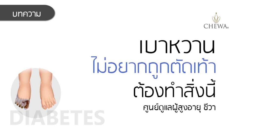 เบาหวาน ตัดเท้า