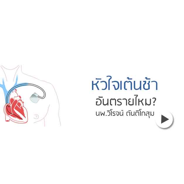 หัวใจเต้นช้า