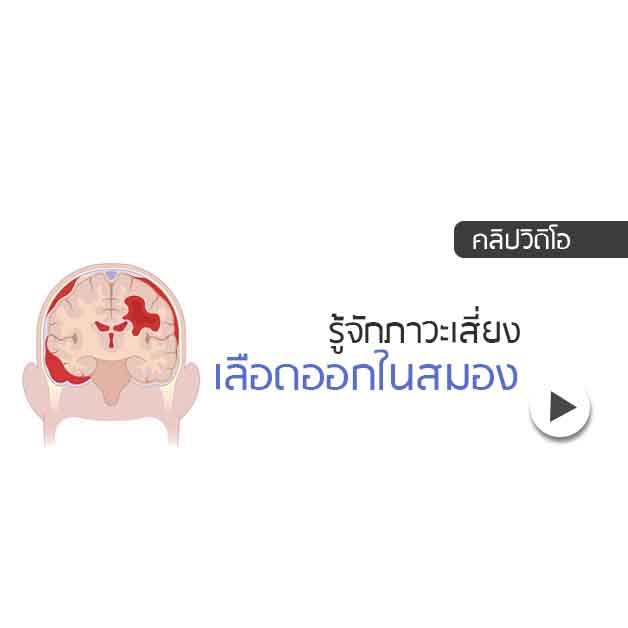 เลือดออกในสมอง