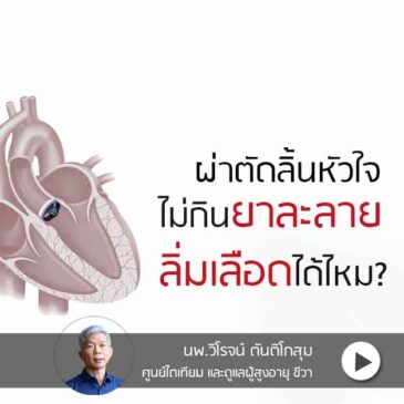 Ep179 ผ่าตัดลิ้นหัวใจไม่กินยาละลายลิ่มเลือดได้?
