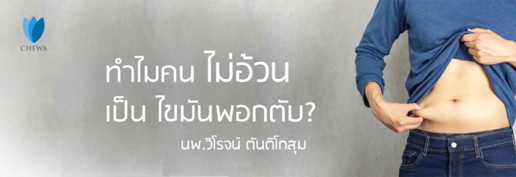 ไขมันพอกตับ