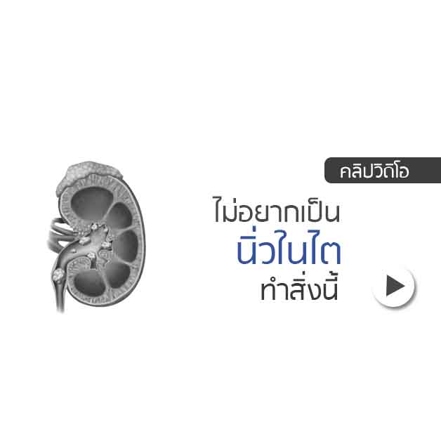 ศูนย์ไตเทียม