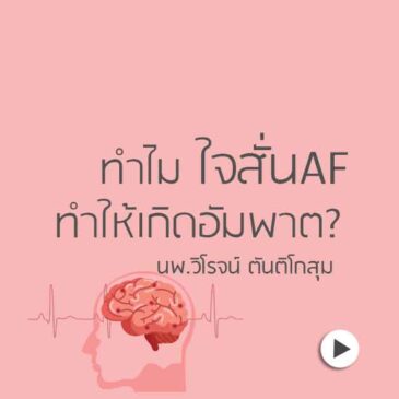 Ep42 ทำไม ใจสั่น AF ทำให้เกิดอัมพาต?