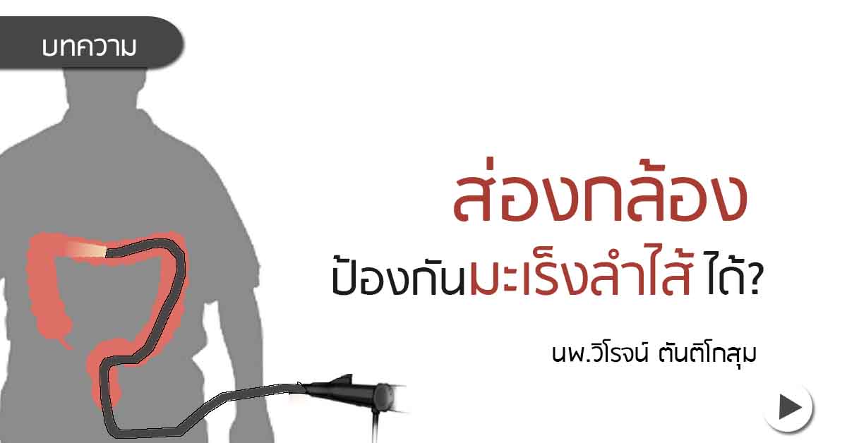 ส่องกล้องลำไส้